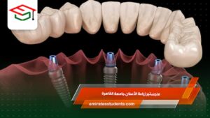 ماجستير زراعة الأسنان جامعة القاهرة